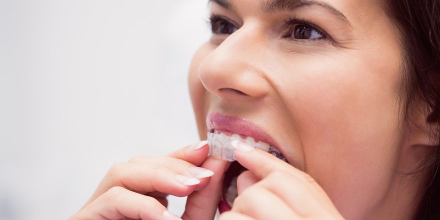 Can You Eat and Drink with Invisalign - Do’s and Don’ts to Follow